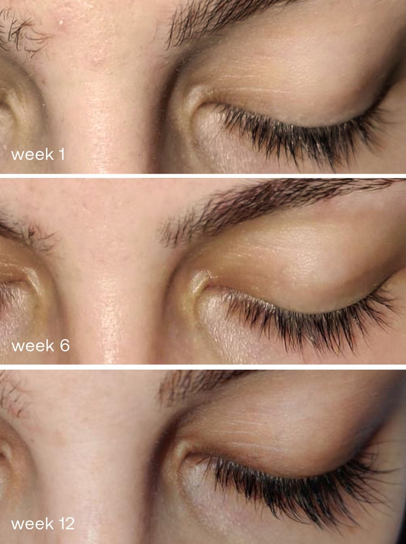 Eyelash Serum - UKLASH