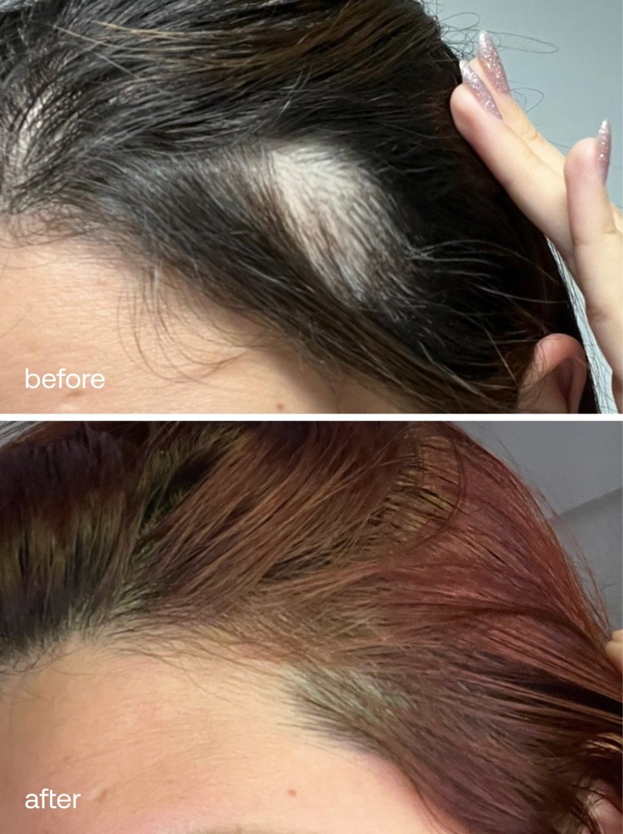 Advanced Scalp Dermaroller - UKLASH