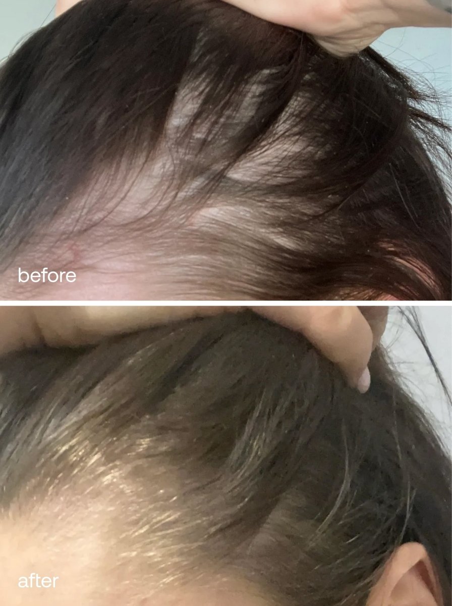 Scalp Massager - UKLASH