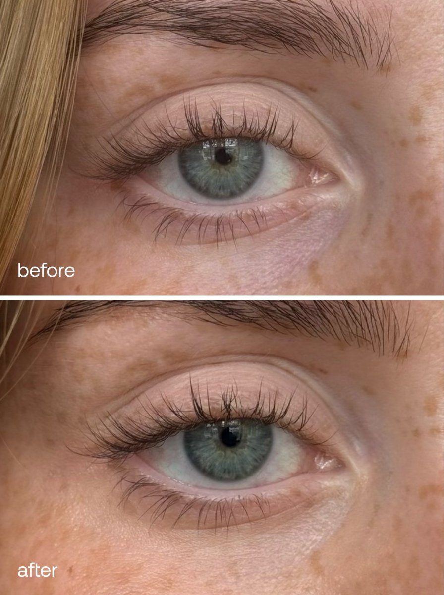 Vitamin C + HA Eye Serum